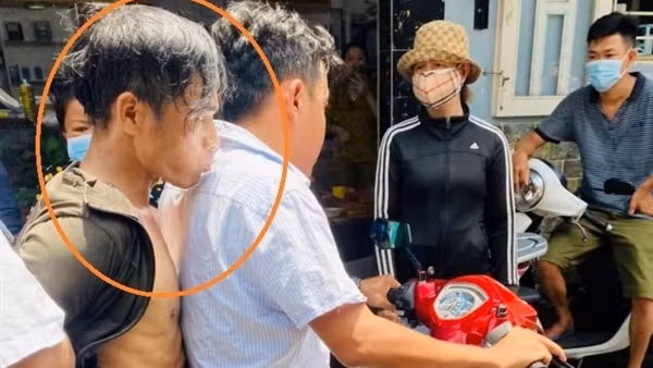 Khống chế kẻ ngáo đá trộm xe cấp cứu phóng bạt mạng qua nhiều tuyến phố ảnh 5