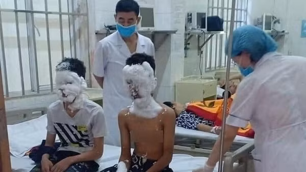 Hiểm họa khôn lường từ pháo nổ tự chế