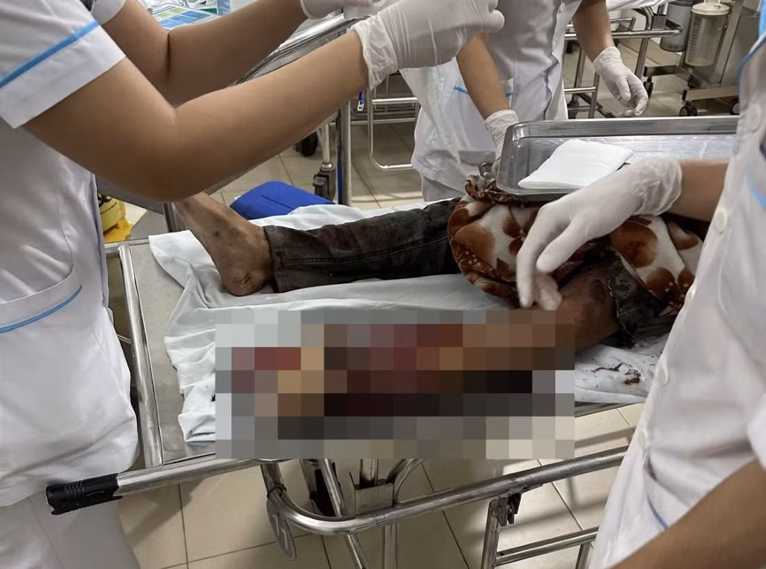 Vợ chồng công nhân đi xe máy về quê thăm con, giữa đường gặp nạn -0