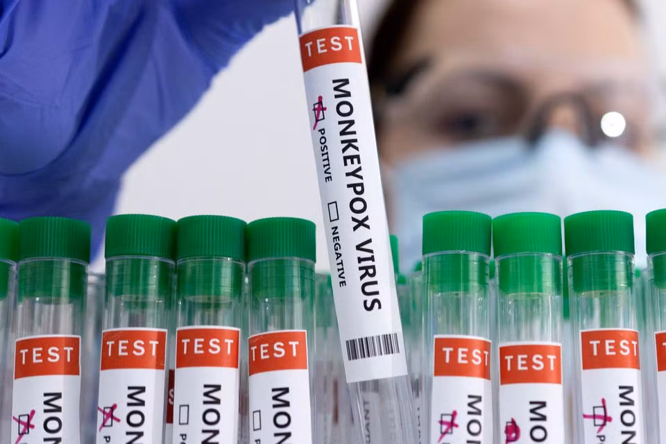 Có cần thiết phải tiêm vaccine đậu mùa khỉ? -0