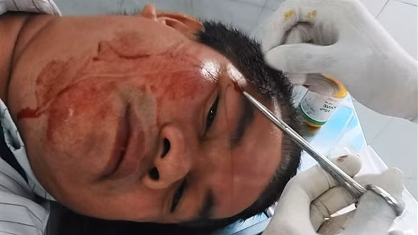 Điều tra nhóm côn đồ xông vào sảnh chung cư hành hung người dân ảnh 2