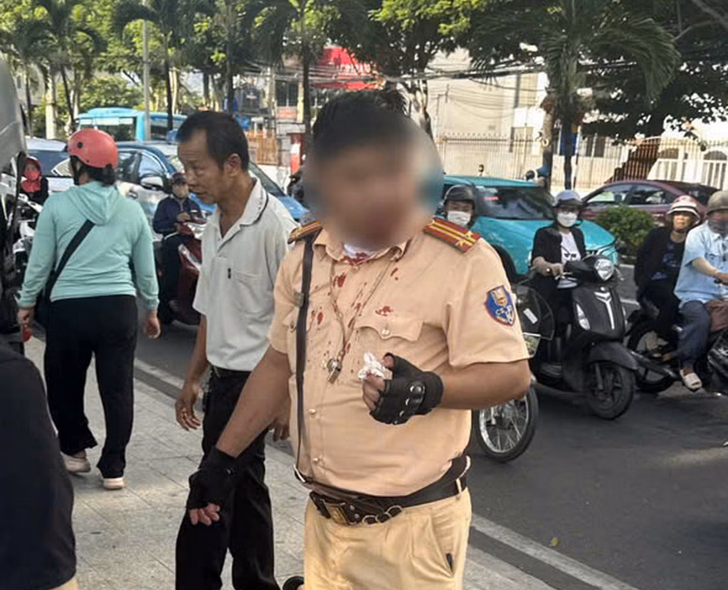 Tạm giữ hình sự một người Nga đấm cán bộ CSGT đang thi hành công vụ. -0