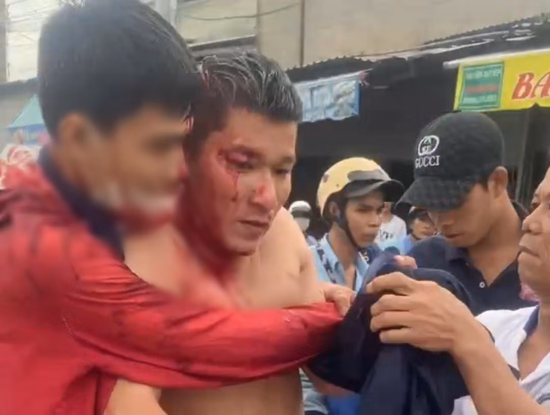 Án mạng từ món nợ 32 triệu đồng -0