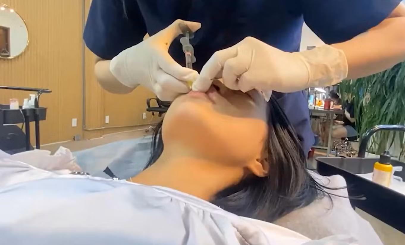 Xử lý nghiêm một cơ sở “thẩm mỹ chui” tiêm filler gây biến chứng -0