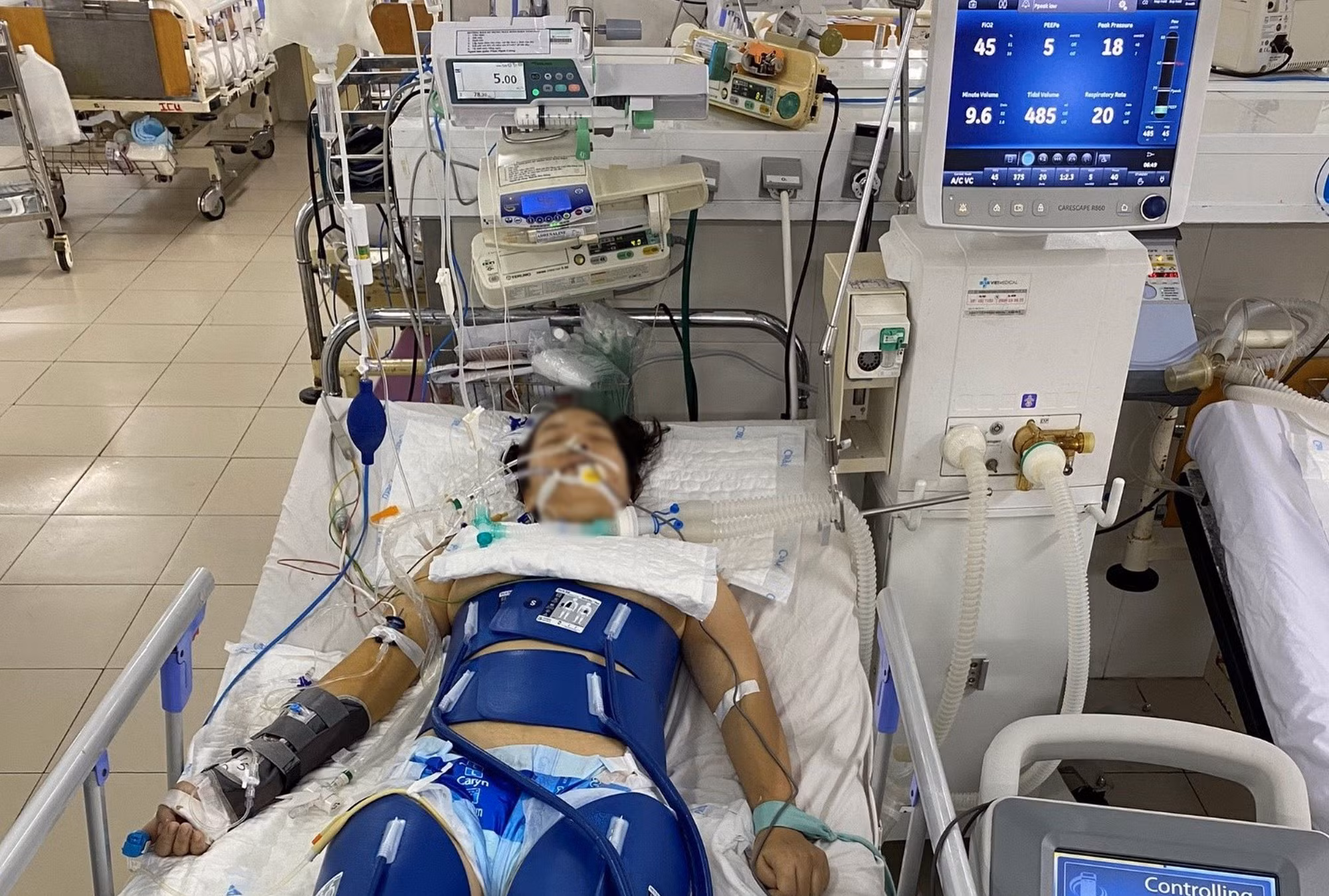 Cứu sống bệnh nhân ngưng tim bằng liệu pháp hạ thân nhiệt chủ động -0