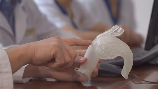 Vinmec áp dụng công nghệ 3D điều trị tim mạch lần đầu tiên ở Đông Nam Á