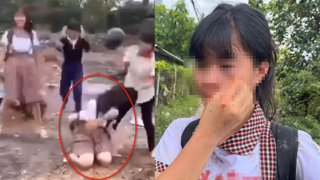 Vụ nữ sinh bị đánh ở Thủ Đức là do trêu chọc nhau về vấn đề cơ thể -0
