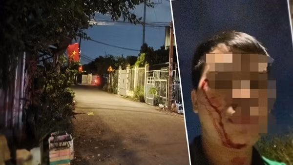 Xác minh thông tin vụ kẻ cướp dùng mũ bảo hiểm tấn công tài xế xe ôm