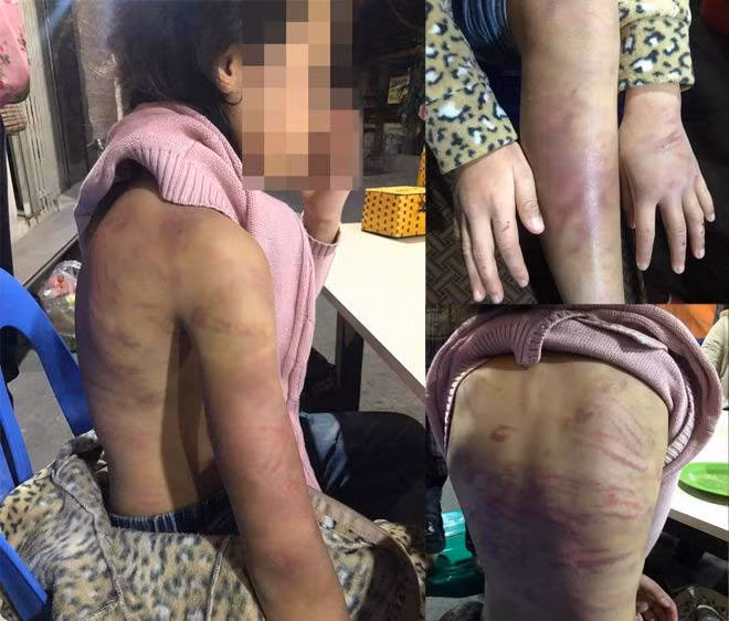 Trẻ cần được bảo vệ sớm hơn -0