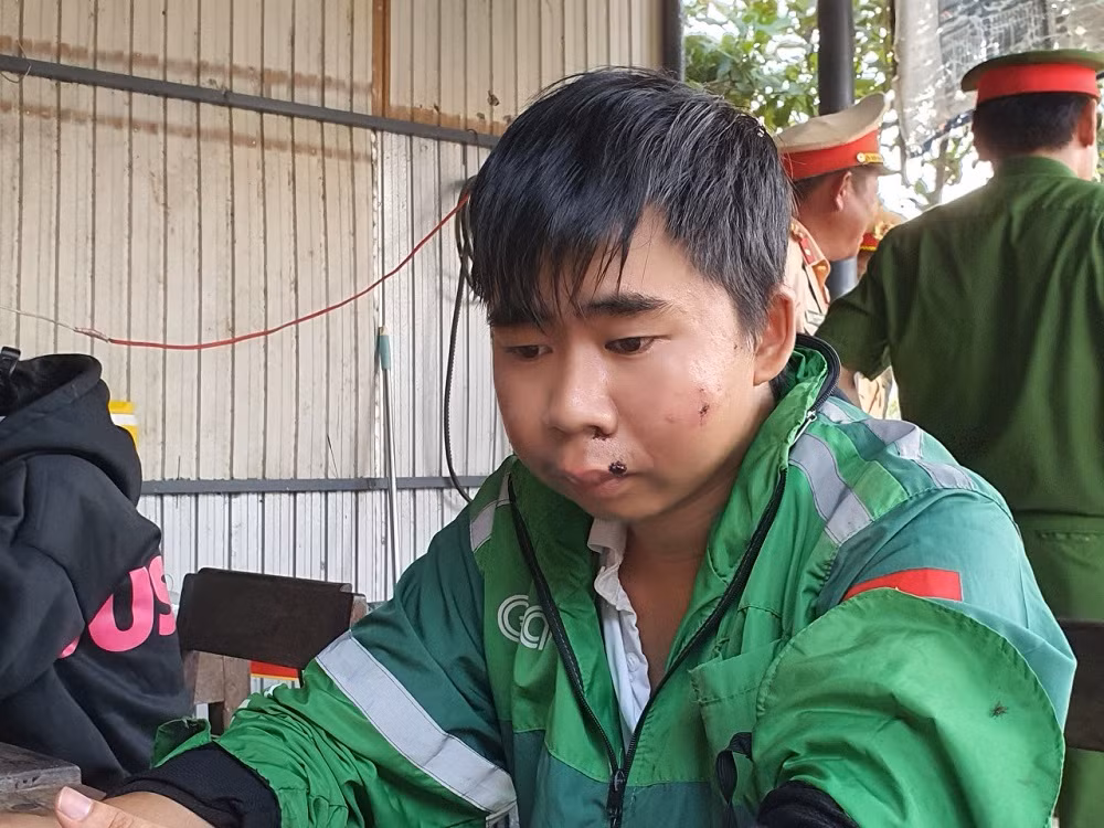 Thăm hỏi, động viên cán bộ CSGT bị thương khi làm nhiệm vụ -0