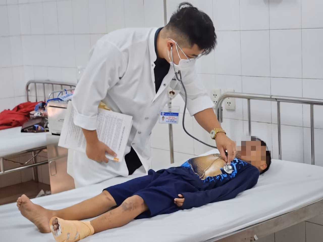 Đốt pháo mua qua mạng, 4 trẻ ở Huế bị bỏng nặng phải nhập viện -0