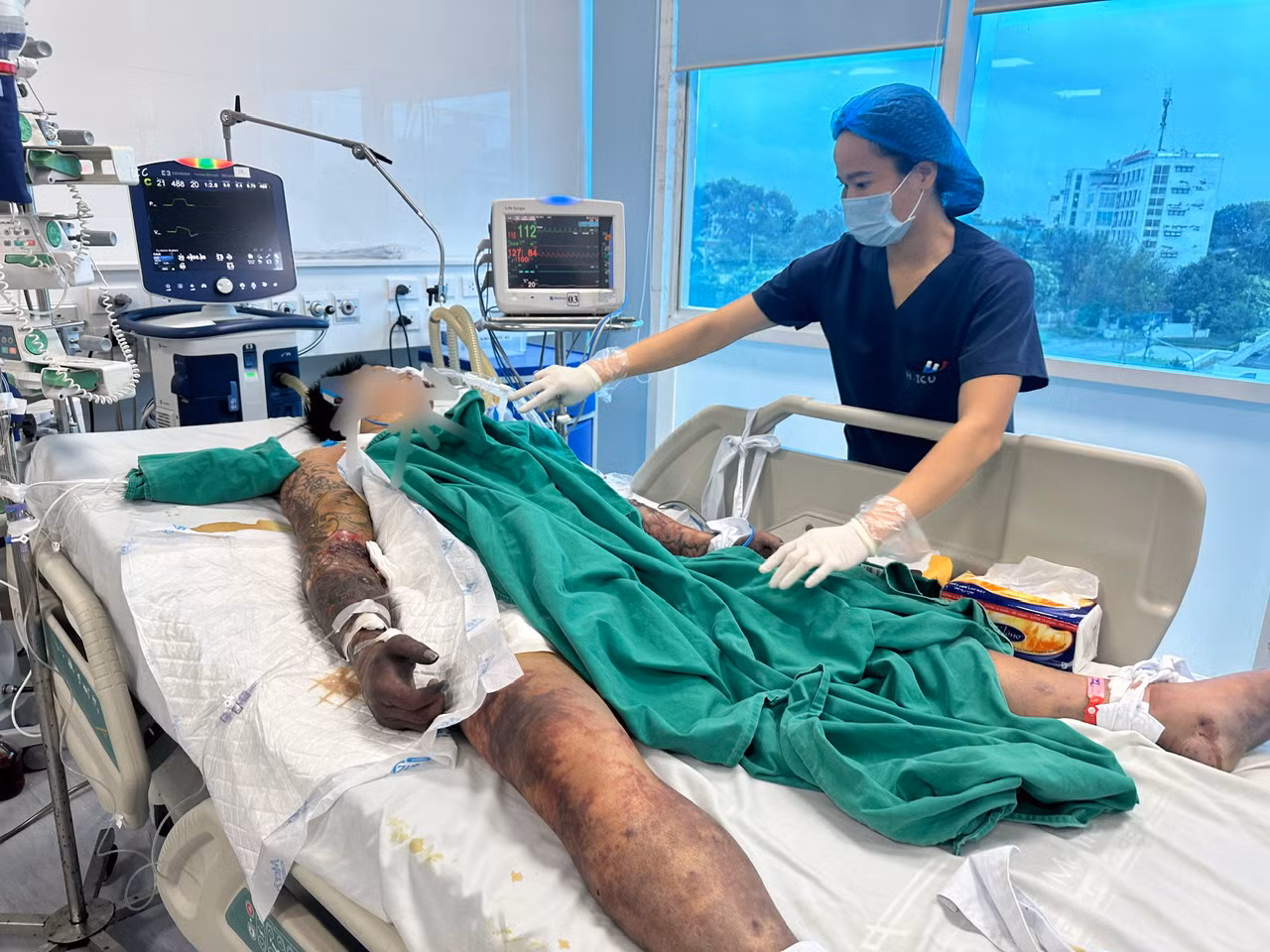 Ăn tiết canh mùng 1 lấy may, nam thanh niên nguy kịch -0