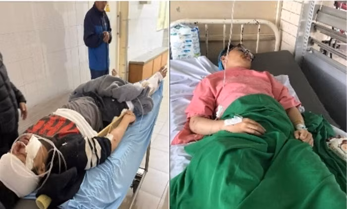 Hai học sinh chấn thương nặng do nhóm côn đồ tấn công nhầm -0