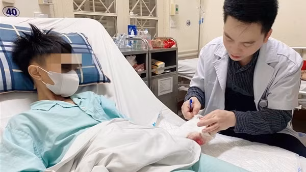 Ba học sinh bị thương nặng do sử dụng pháo tự chế