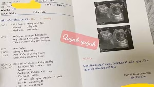 Thừa Thiên-Huế: Triệt phá đường dây mang thai hộ và mua bán thận liên tỉnh