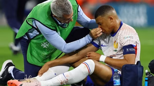 ĐT Pháp có thể thiếu&nbsp;Kylian Mbappe đến hết Euro 2024