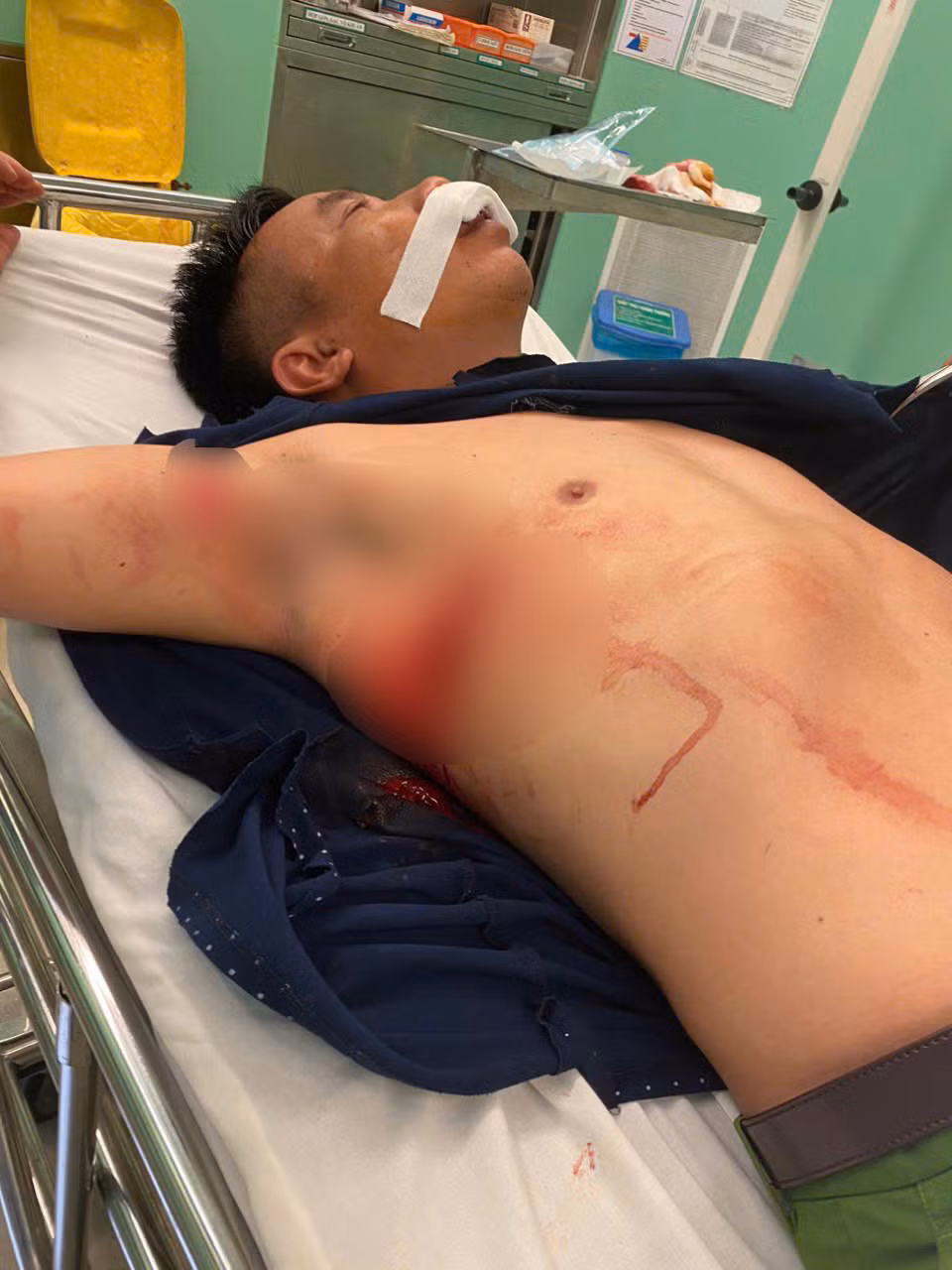 Bắt đối tượng hung hãn gây thương tích nặng cho cán bộ Công an -0