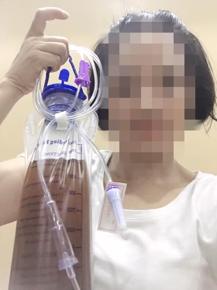 Thực hư thải độc bằng cà phê -0