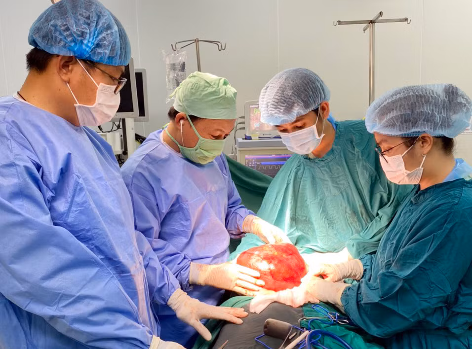 Cắt bỏ thành công khối u “khổng lồ” trong bụng người đàn ông -0