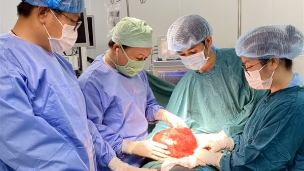 Cắt bỏ thành công khối u “khổng lồ” trong bụng người đàn ông