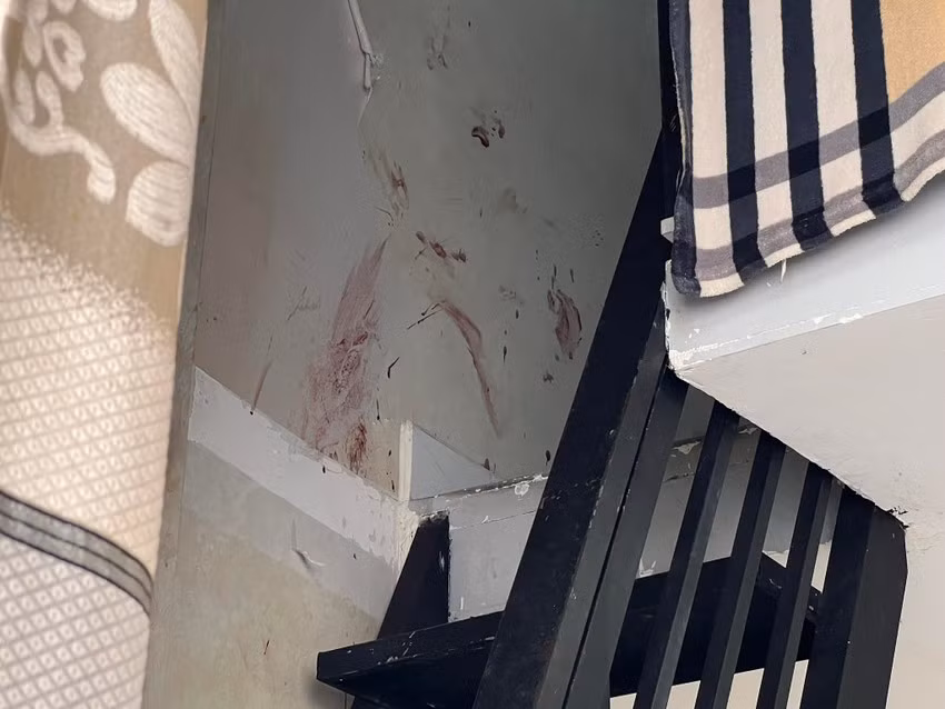 Đang điều tra vụ cha dượng và con gái tử vong bất thường trong nhà trọ -0