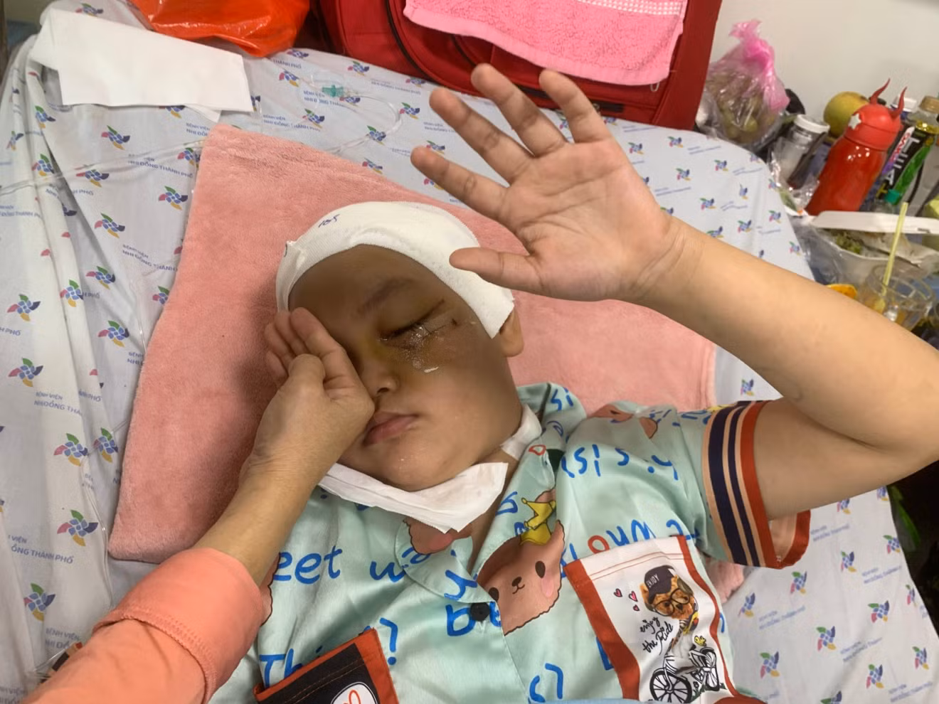 Bé gái 9 tuổi bị tay phanh xe đâm vào ổ mắt trái và nhu mô não -0
