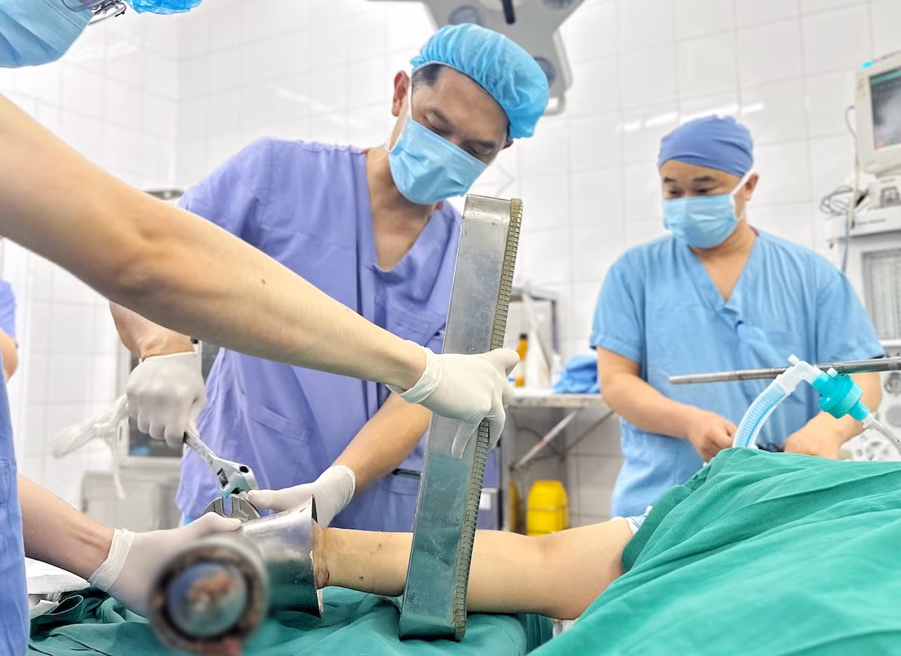 Người phụ nữ đến cấp cứu với bàn tay nằm trong máy xay thịt -0