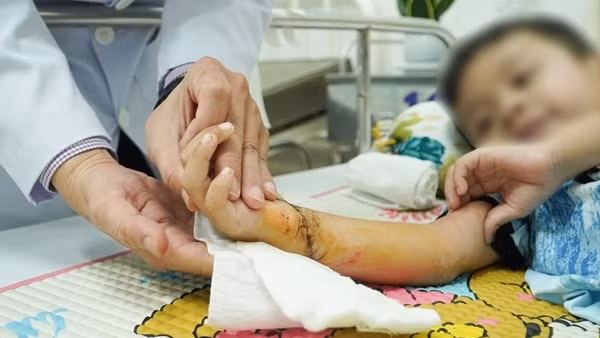 Kịp thời nối liền cánh tay bị đứt lìa cho bé 5 tuổi