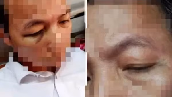 Chỉ vì việc đóng mở cổng trường, hiệu trưởng đánh hiệu phó nhập viện