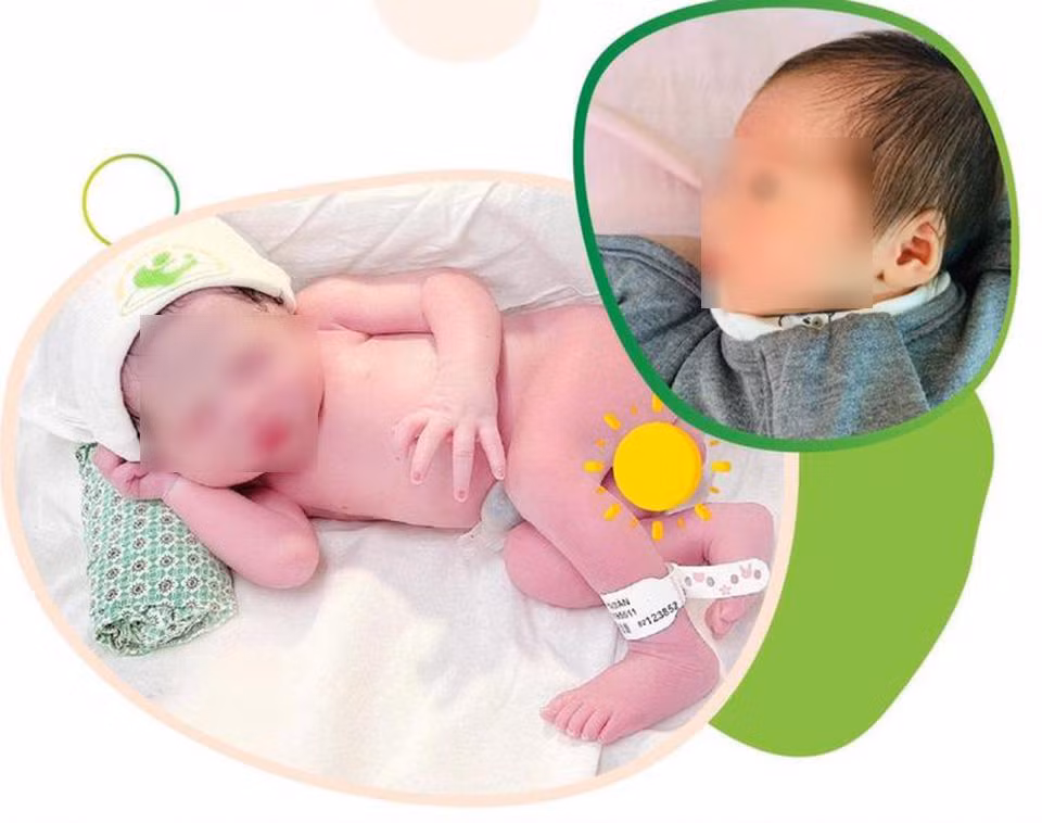 Em bé chào đời khoẻ mạnh từ người mẹ ghép thận -0