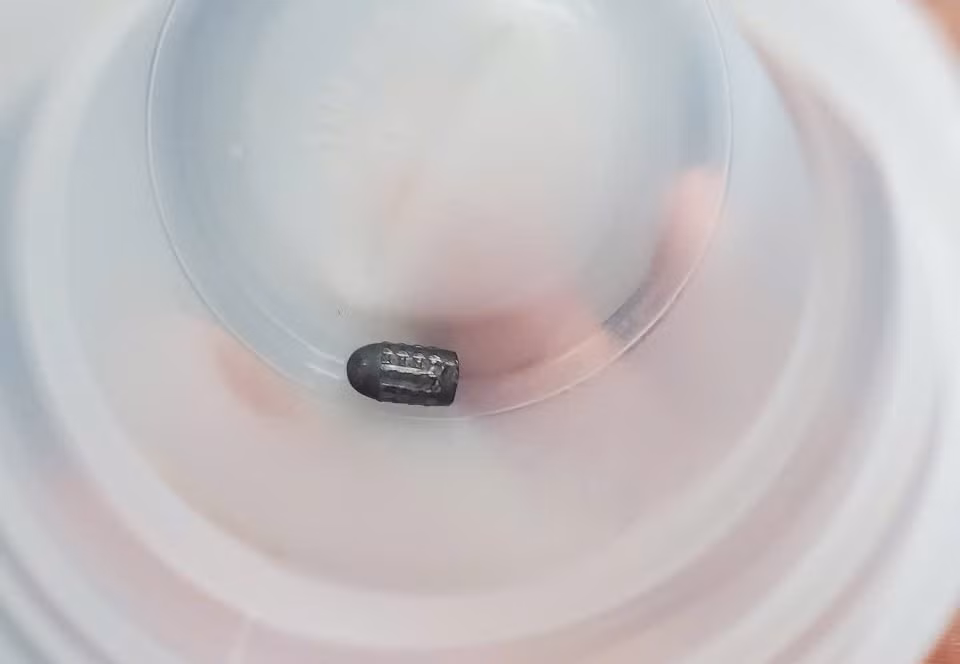 Bị đạn bắn trúng đầu khi đang làm vườn -0