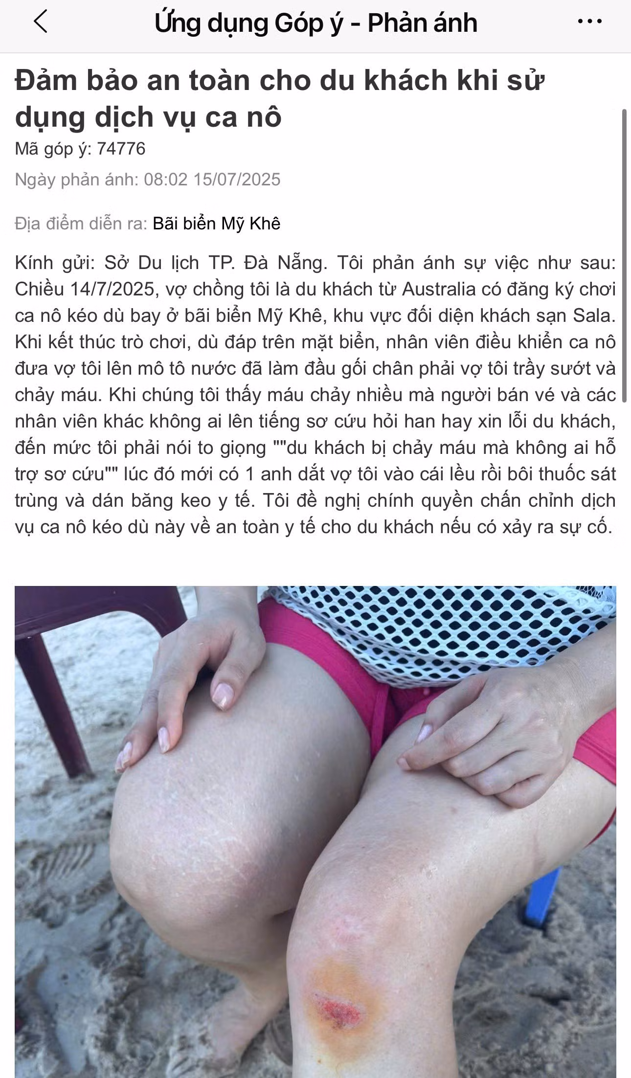 Đà Nẵng: Chấn chính dịch vụ ca nô kéo dù sau sự cố du khách nước ngoài bị thương -0