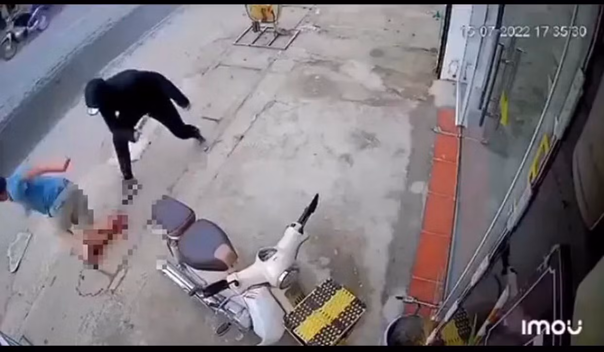 Điều tra vụ một thanh niên bị chém đứt lìa chân tại Hà Nội -0