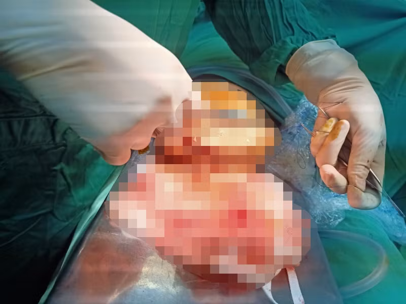 Nối thành công “của quý” bị cắt rời của một phạm nhân -0