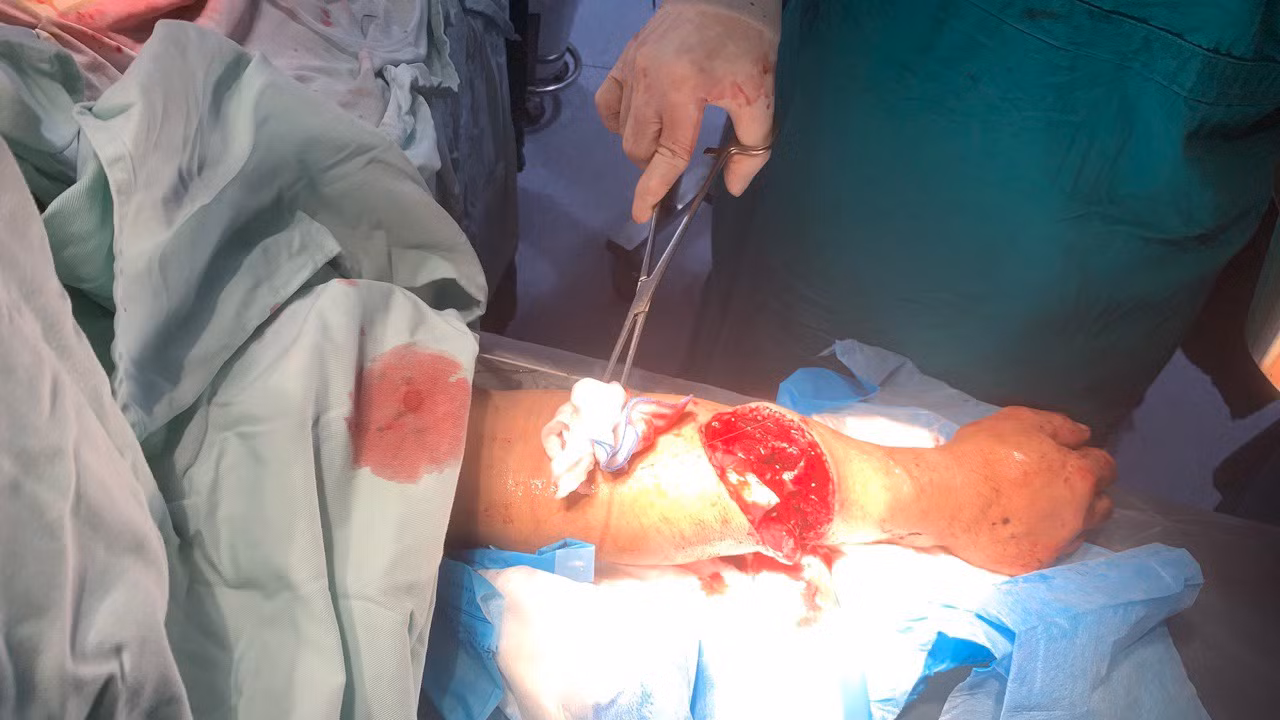 Bị hàng xóm dùng dao đâm chém, 1 người chết, 2 người nguy kịch