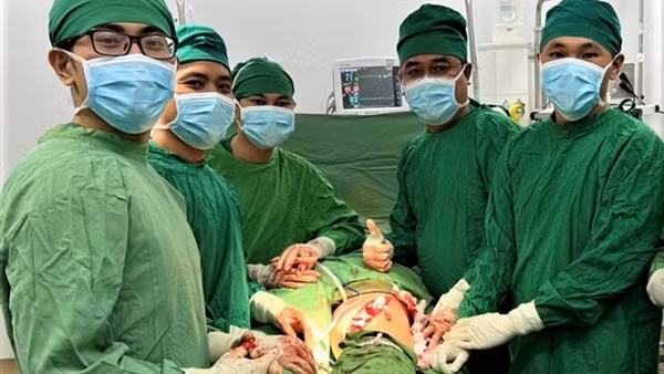 Bị biến dạng khuôn mặt vì khối u hiếm vùng tuyến nước bọt ảnh 2