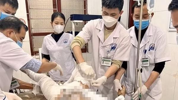 Cãi nhau với vợ, chồng đổ nửa can xăng tự thiêu