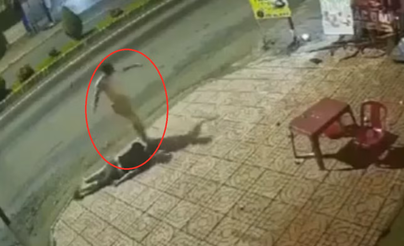 Khởi tố vụ án kẻ tâm thần tấn công, tạt nước sôi vào người khác -0
