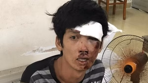 Tên cướp đột nhập Điện máy Xanh lấy 1,5 tỷ đồng khai về "chiếc cửa lỗi khoá" ảnh 7