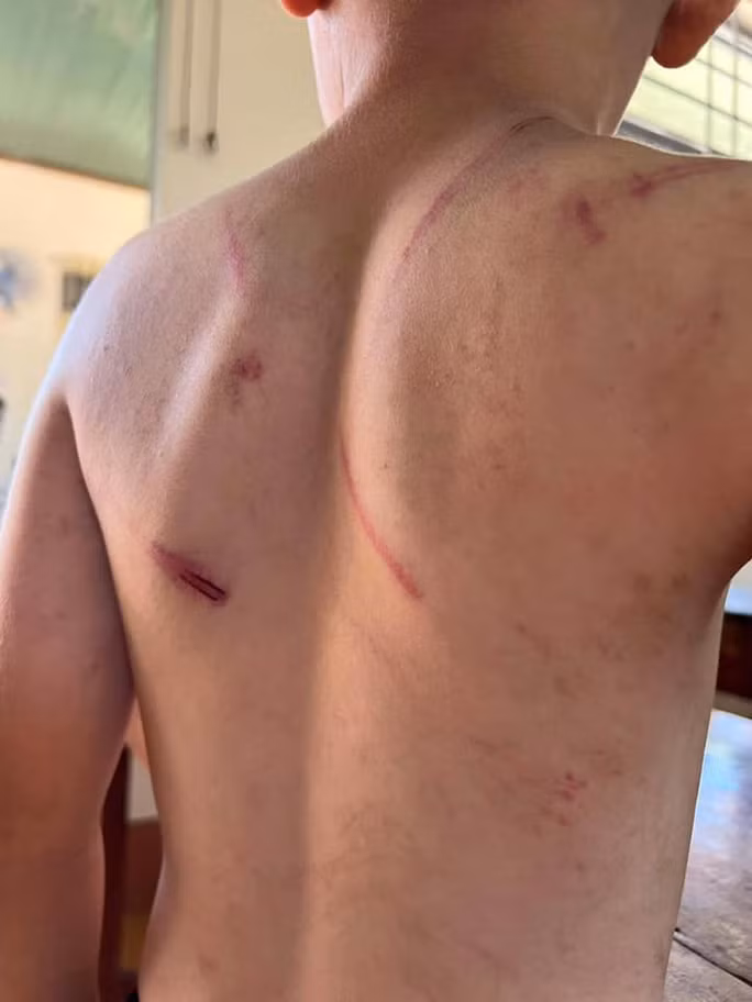 Bà nội cùng cha đẻ nhiều lần đánh đập cháu bé 9 tuổi -0
