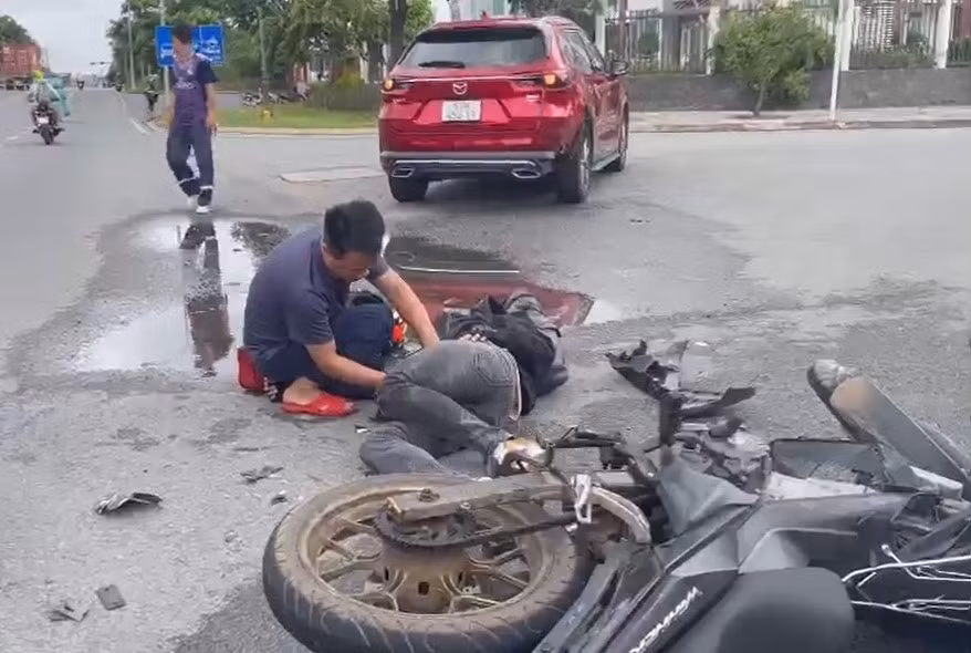 Kịp thời cứu nam thanh niên gặp tai nạn gãy chân trên đường -0