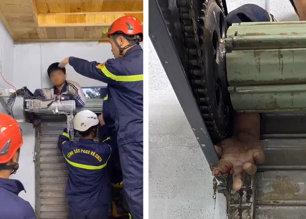Kịp thời giải cứu bé trai bị kẹt tay vào cửa cuốn -0