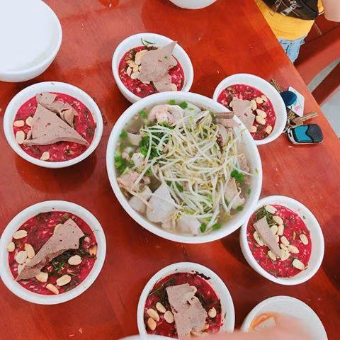 Điếc đột ngột sau khi ăn tiết canh -0