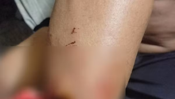Cướp tài sản xong còn bắt nạn nhân nấu mì để ăn