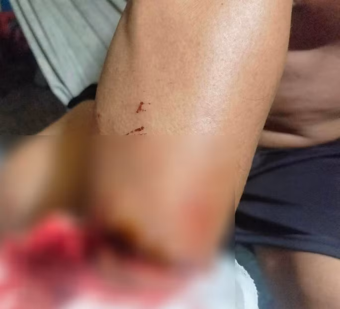 Khởi tố 2 tên cướp tài sản... còn bắt nạn nhân nấu mì để ăn -0