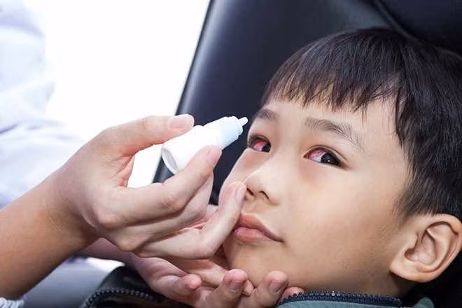 Bộ Y tế đưa ra 5 khuyến cáo phòng dịch đau mắt đỏ -0