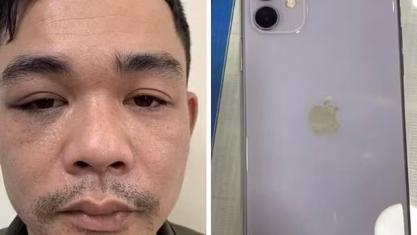 3 lần chuốc thuốc ngủ, cướp Iphone 11 của bạn gái