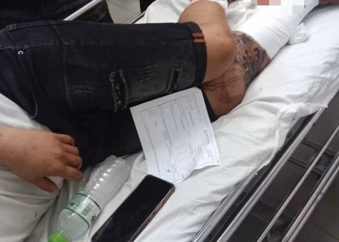 Truy xét khoảng 10 đối tượng cầm dao phóng lợn chém tài xế xe du lịch trên quốc lộ -0