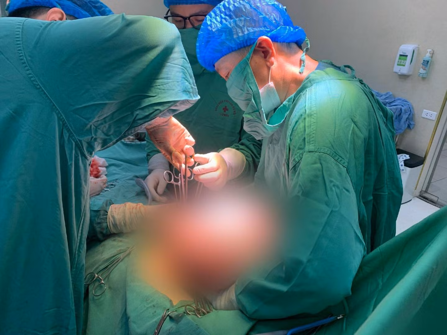 Tưởng béo bụng, hoá ra mang khối u buồng trứng khổng lồ -0