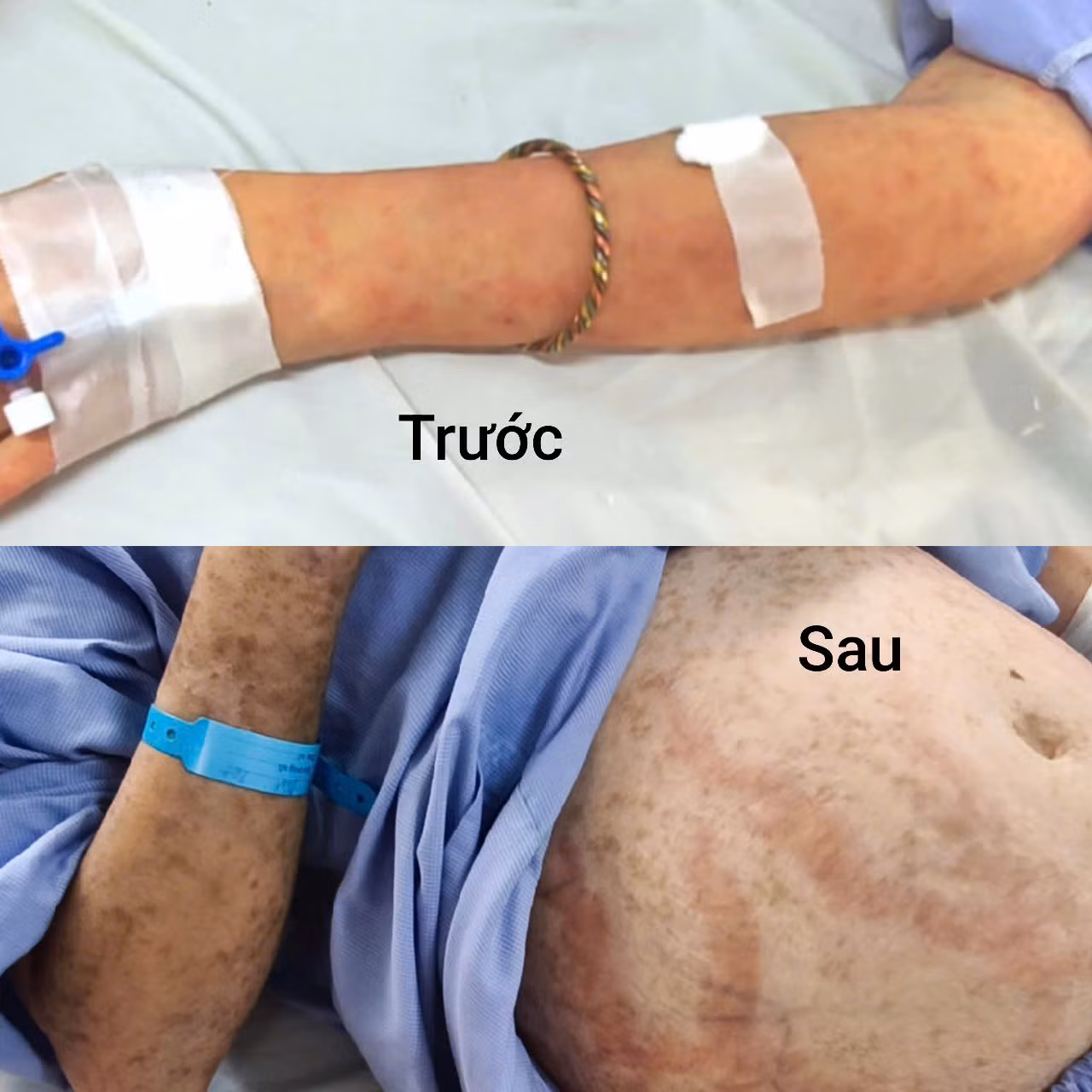 Tự làm 